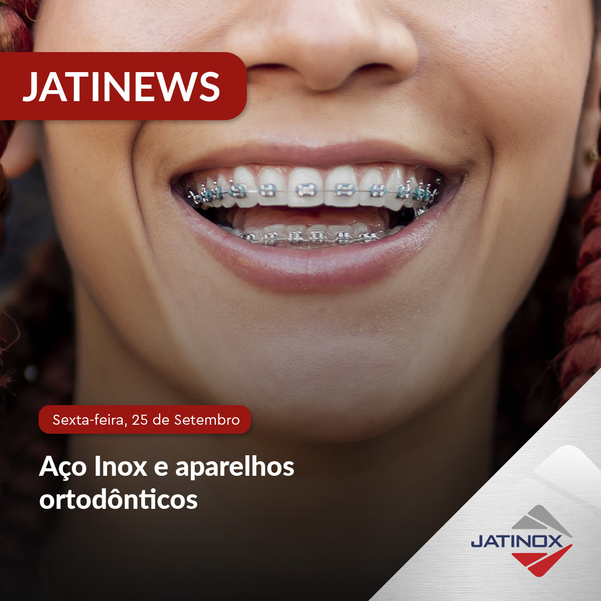 Aço Inox e aparelhos ortodônticos Aço Inox e aparelhos ortodônticos